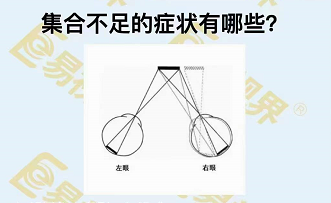 集合不足的癥狀有哪些？